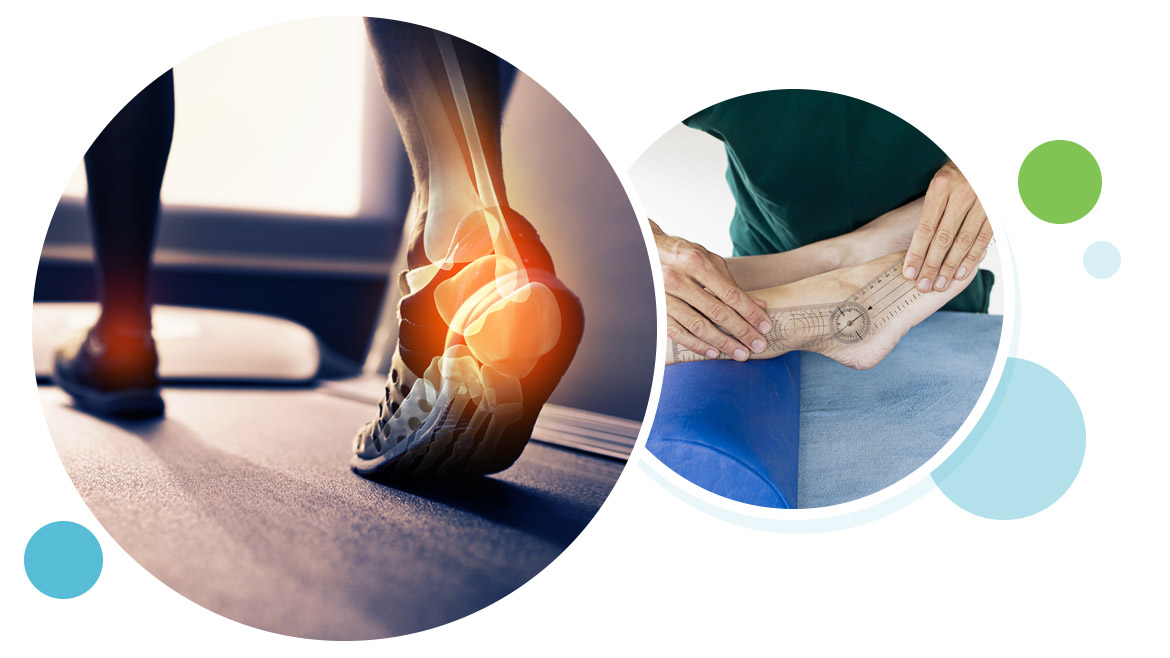 Ankle instability, The ankle, Biomechanical problems, What We Treat