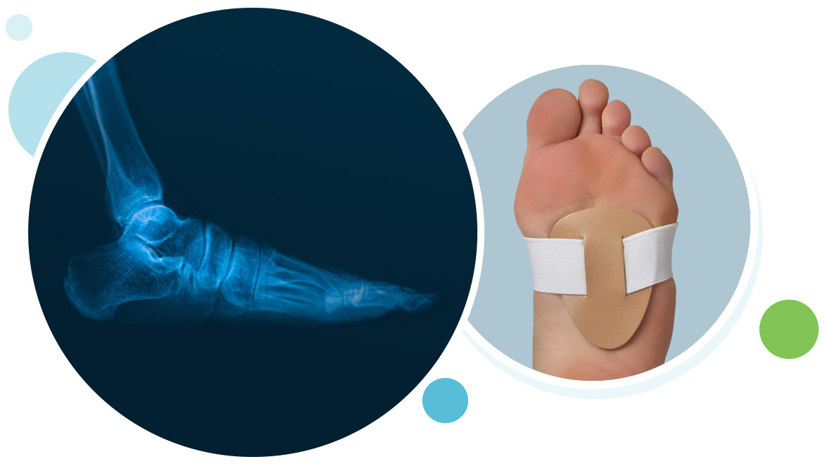 What to Do About Flat Feet: Neuhaus Foot & Ankle: Podiatry