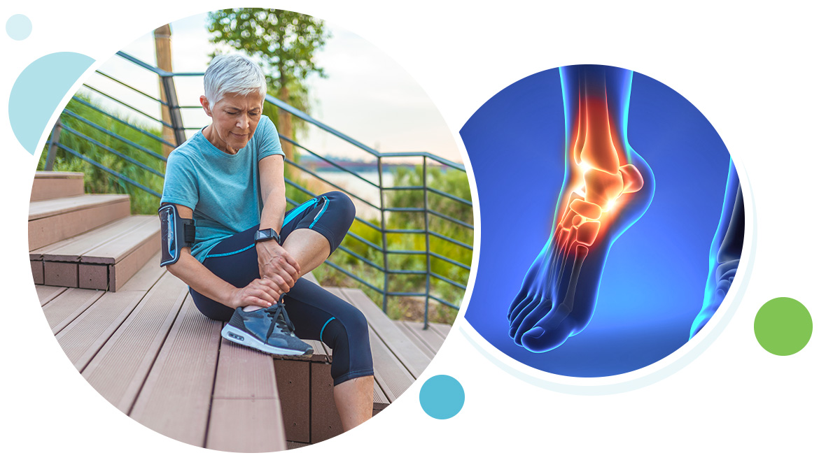 What Is Ankle Arthritis? - Northstate Foot and Ankle Specialists