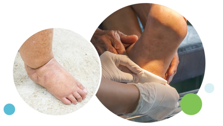 A Podiatrist’s Guide To Diabetic Foot Care